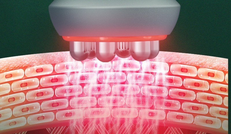 Aparat profesional cavitatie cu radiofrecventa vaccum rf M930